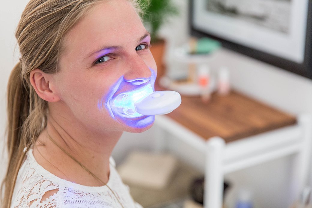 5 Best Teeth Whitening Strips Feb. 2018 BestReviews