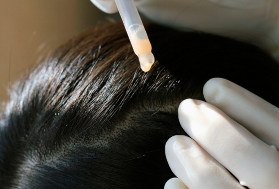 Best scalp treatment options for dryness, itchiness and product buildup