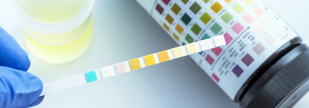 5 Best Ketone Test Strips - June 2021 - BestReviews