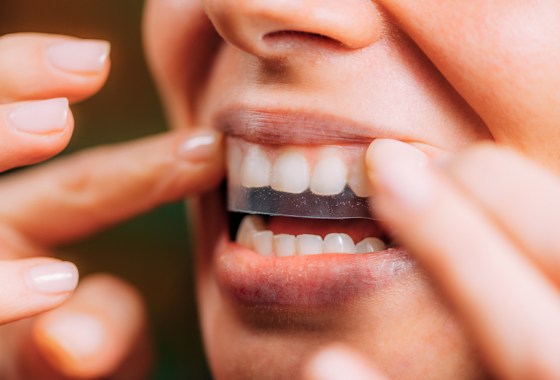 Best Crest Whitestrips